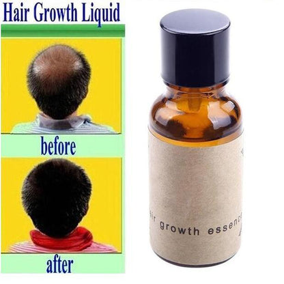 Hair growth liquid