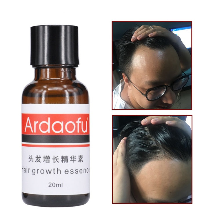 Growth, hair loss, hair growth prevention